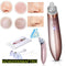 Blackhead Remover Machine