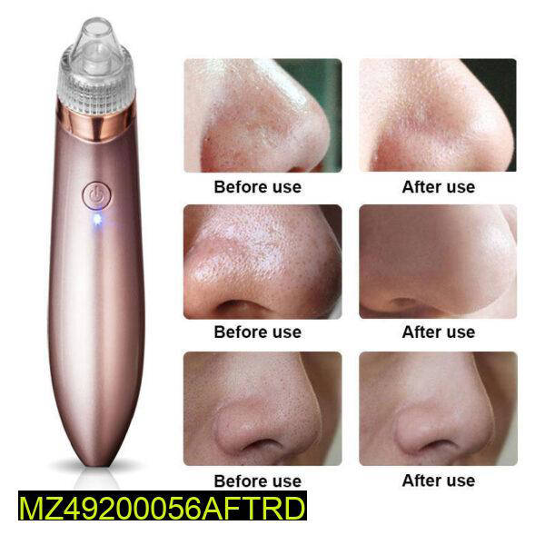 Blackhead Remover Machine